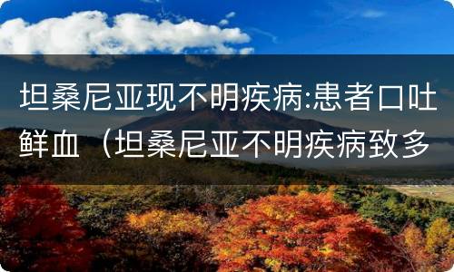 坦桑尼亚现不明疾病:患者口吐鲜血（坦桑尼亚不明疾病致多人死亡 超50人住院接受治疗）