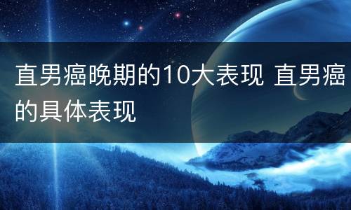 直男癌晚期的10大表现 直男癌的具体表现
