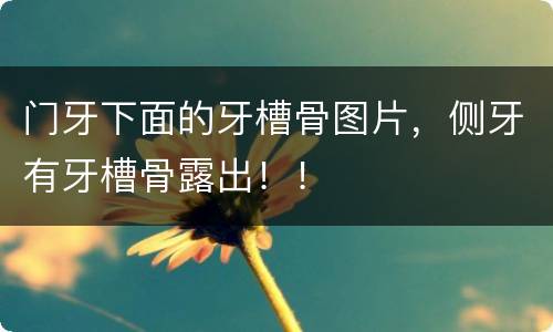 门牙下面的牙槽骨图片，侧牙有牙槽骨露出！！