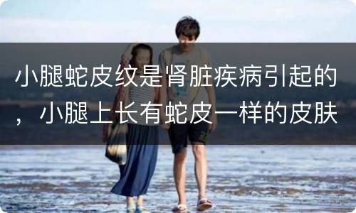 小腿蛇皮纹是肾脏疾病引起的，小腿上长有蛇皮一样的皮肤怎么回事
