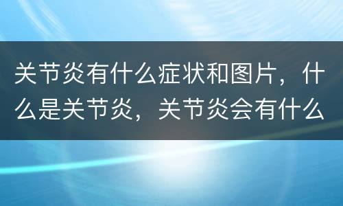 关节炎有什么症状和图片，什么是关节炎，关节炎会有什么症状