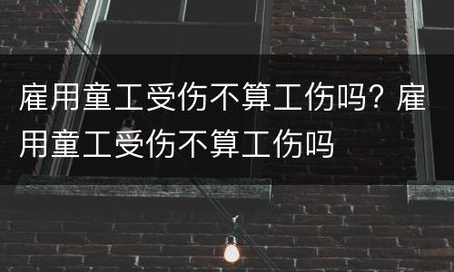 雇用童工受伤不算工伤吗? 雇用童工受伤不算工伤吗