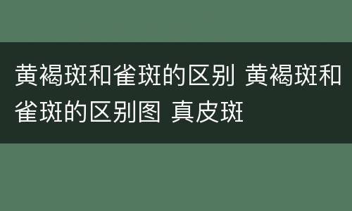 黄褐斑和雀斑的区别 黄褐斑和雀斑的区别图 真皮斑